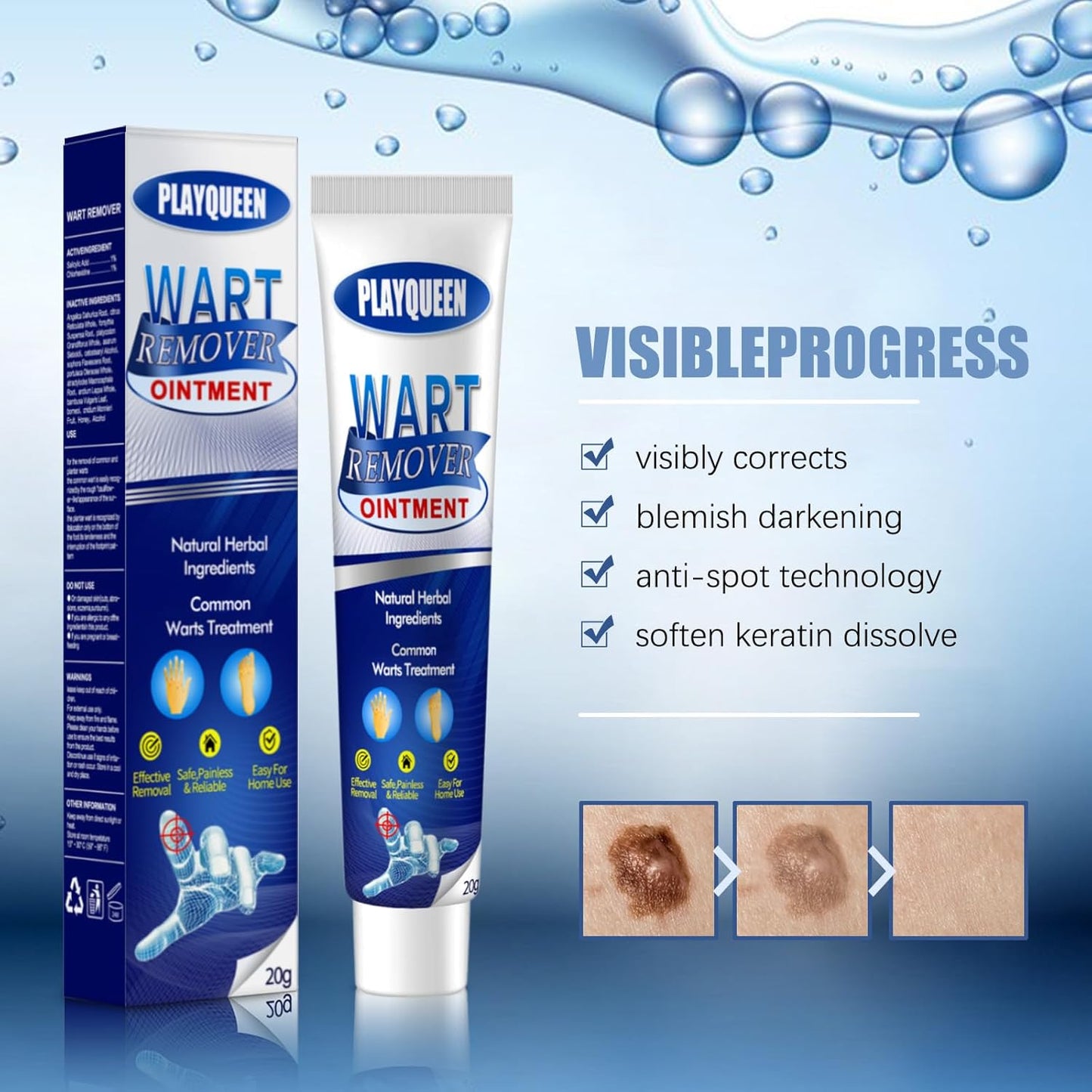 Skin Warts Removal Cream- Buy 1 Get 1 Free