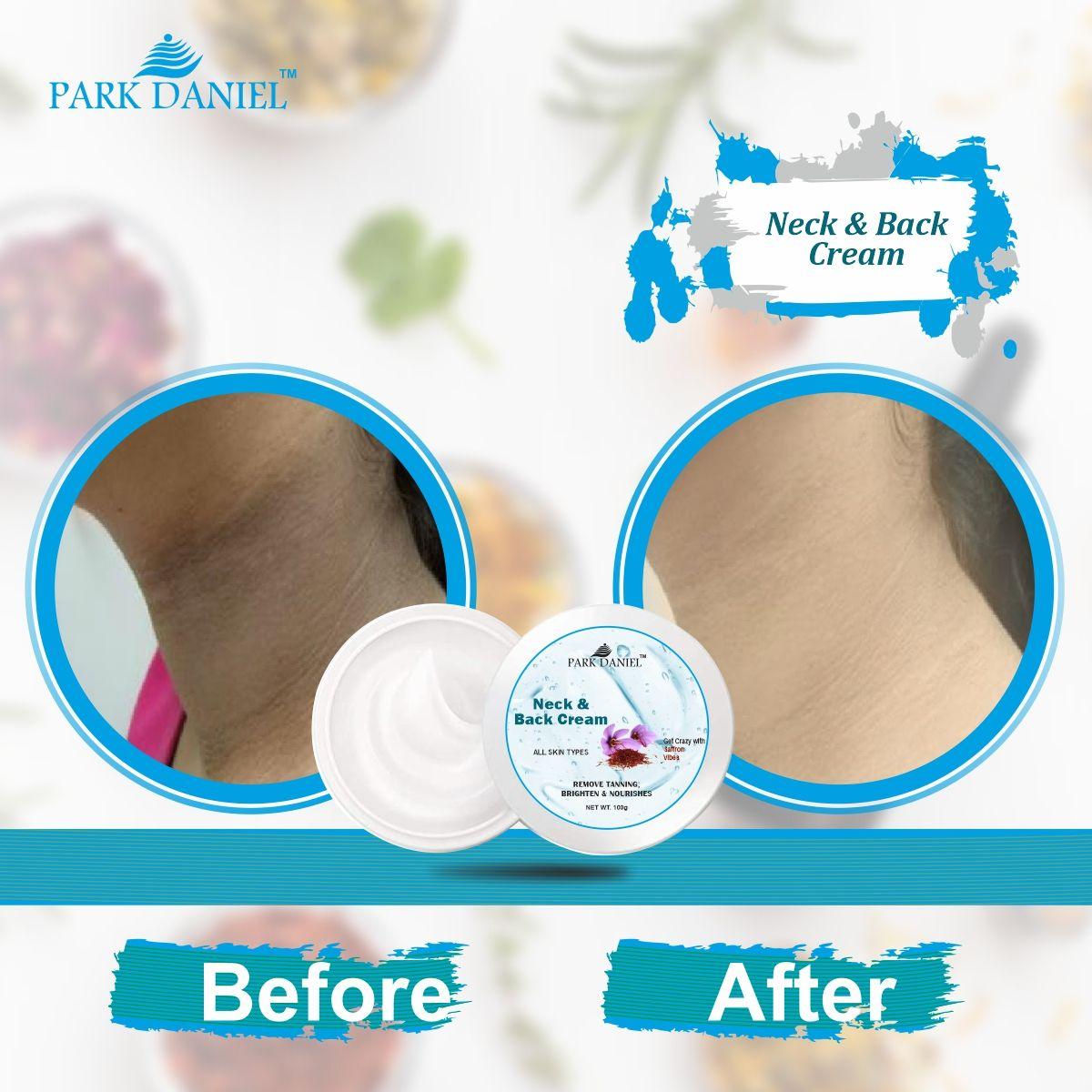 Neck and Back Whitening Cream - Dead Skin Cells Repair