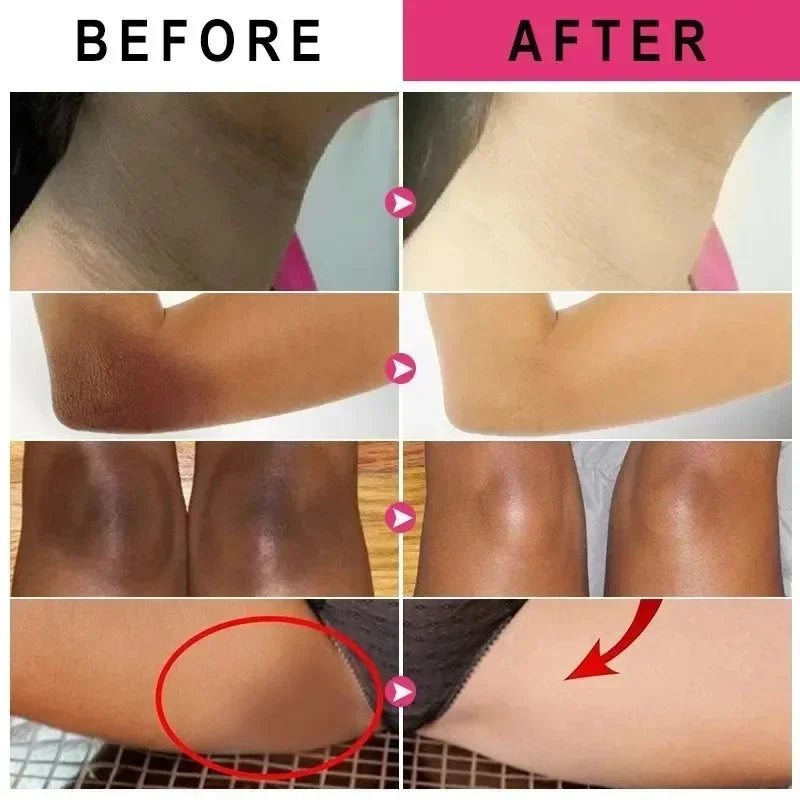 Neck and Back Whitening Cream - Dead Skin Cells Repair