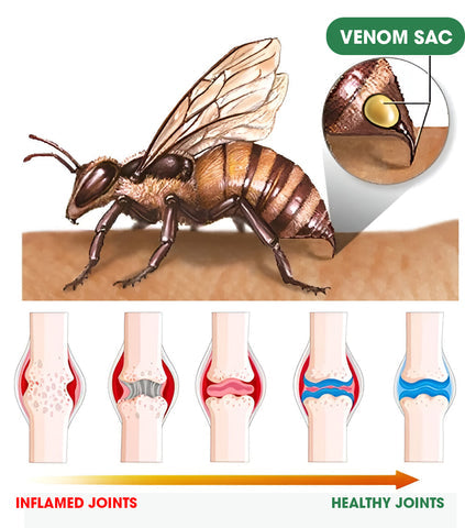 Ultra Strong Bee Venom Pain Relief Cream (BUY 1 GET 1 FREE)